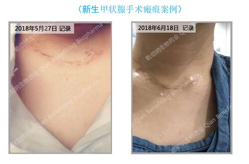 888(1)_看圖王.jpg